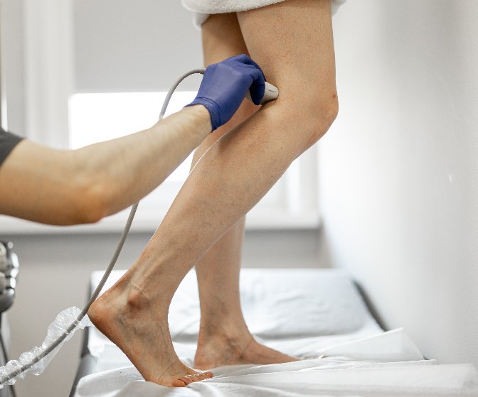 Doctor scanning woman's leg for laser vein treatment
