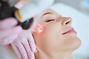 Woman getting Secret PRO microneedling treatment