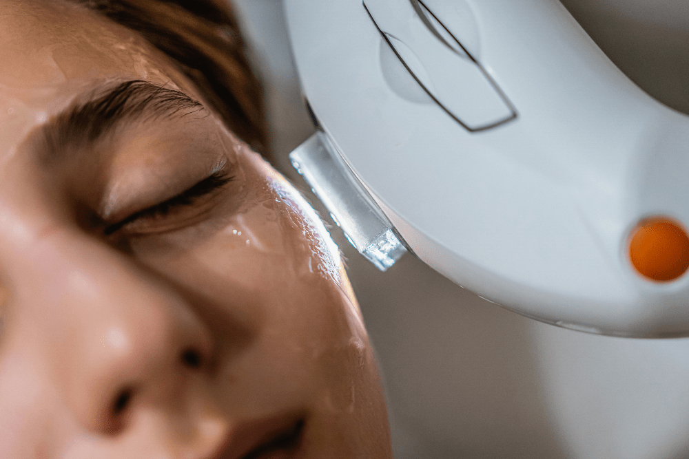 Woman getting photorejuvenation treatment on her face