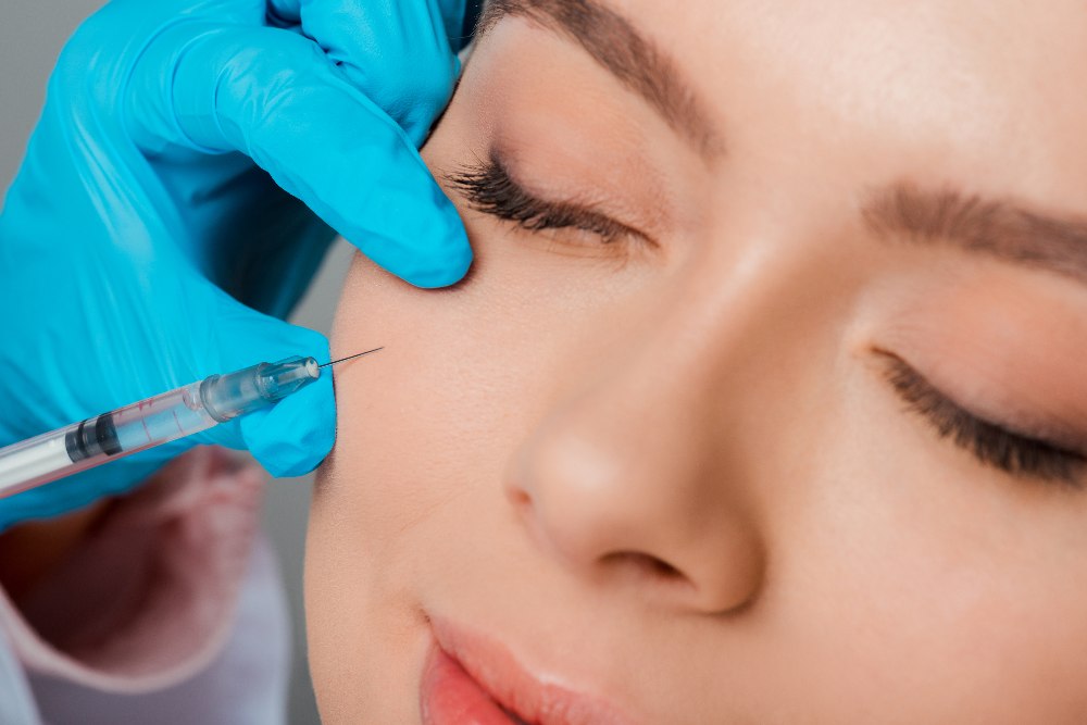 Do you notice fine lines or creases under your eyes when you smile? Under-eye Botox is