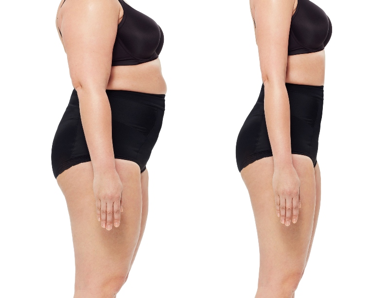 Before and after of a woman's profile Before and after of a woman's profile